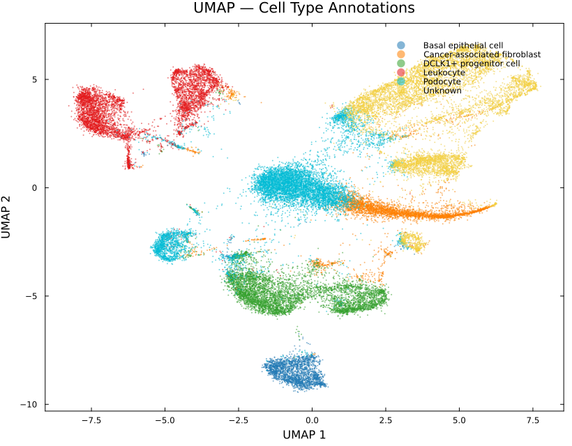 Breast cancer cell type annotation